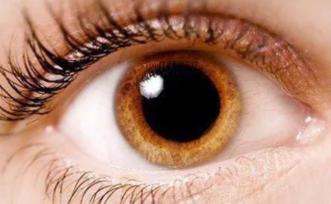 女子左眼瞳孔变大2倍找不到病因 可能的因素有哪些？