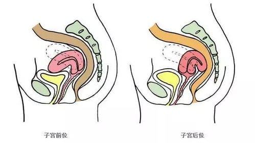 女性腰疼的原因有哪些 治疗腰疼的黄金时间可别耽误了