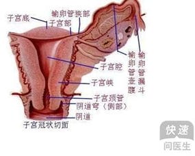 出血性输卵管炎并发症 引起出血性输卵管炎的原因