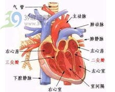 先天性主动脉瓣窦动脉瘤破裂 