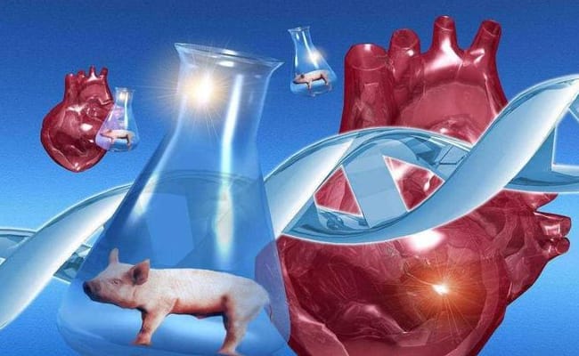 全球首例猪心脏移植人类失败的原因有哪些