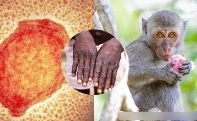 辽宁沈阳发现一例猴痘病例 猴痘有哪些危害