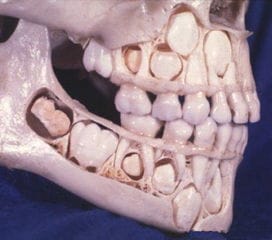 幼儿头骨结构图(幼儿头骨牙齿结构图)
