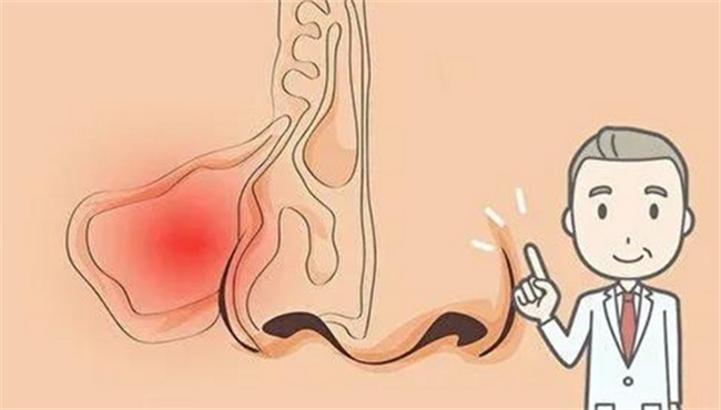 挖鼻孔会不会导致颅内感染  颅内感染是什么