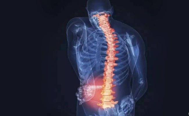 ​长时间坐姿对脊椎健康有什么影响  脊椎健康保护措施有什么