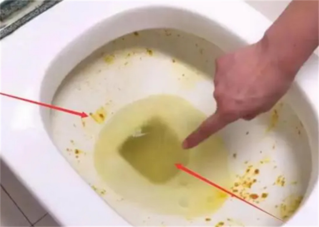 马桶边缘总有黄渍，洗不干净怎么办 两个办法 秒变新马桶