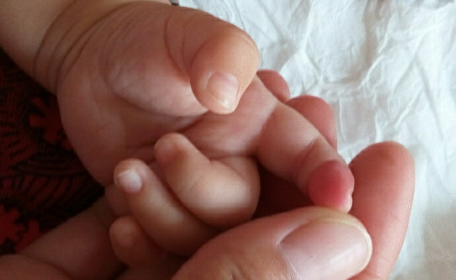 10个月宝宝食指倒刺被拔送PICU抢救 给人们了哪些启示