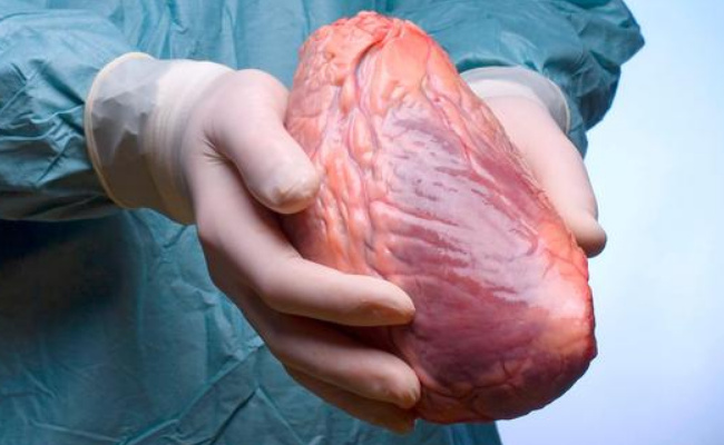 ​全球第二例猪心移植患者手术满月 未出现排异反应 说明了哪些问题