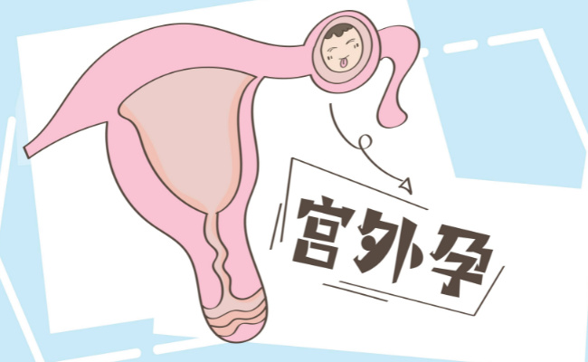 胚胎移植后宫外孕有哪些症状  宫外孕是什么