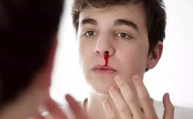 止鼻血的正确方法是什么   怎样止鼻血可能窒息身亡