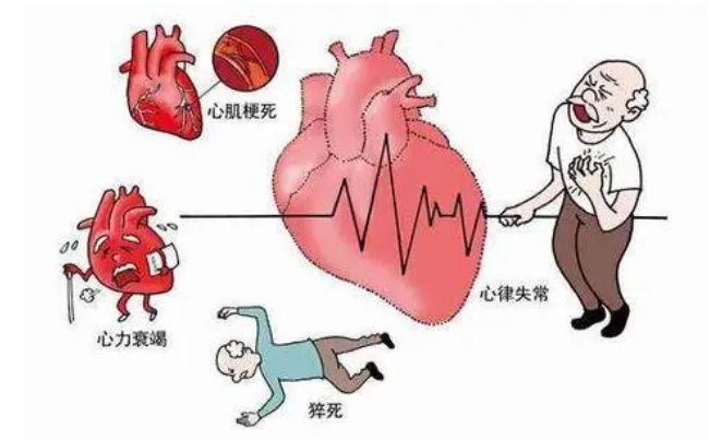 经常胸闷乏力会是心梗前兆吗 心梗的原因有哪些