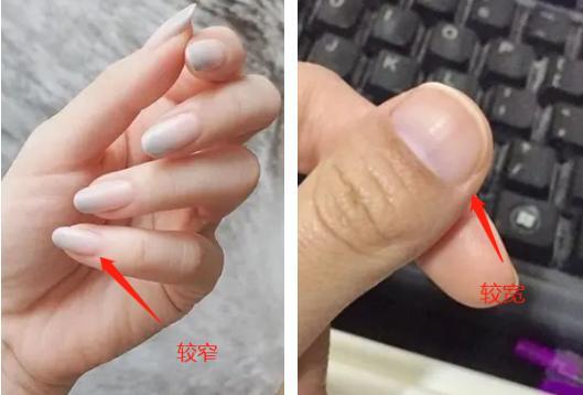看手指甲算命 肝癌征兆的指甲图片