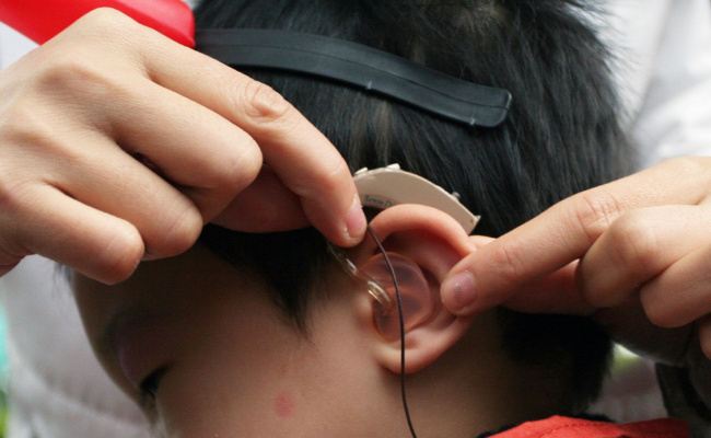 人工耳蜗和助听器有什么区别  人工耳蜗是什么