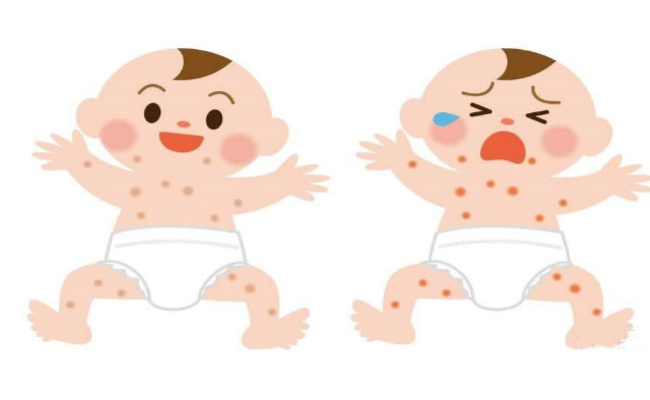 ​宝宝的湿疹为何反复发作 怎样才能根除湿疹