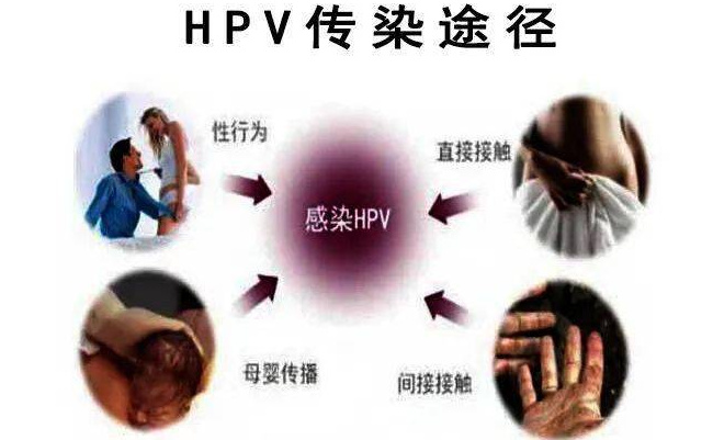 ​HPV感染要谨记哪些能转阴，HPV感染要注意事项有哪些