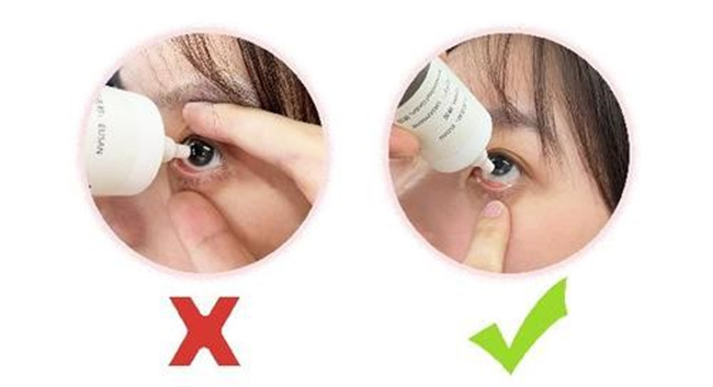 眼药水正确的眼药水使用方法
