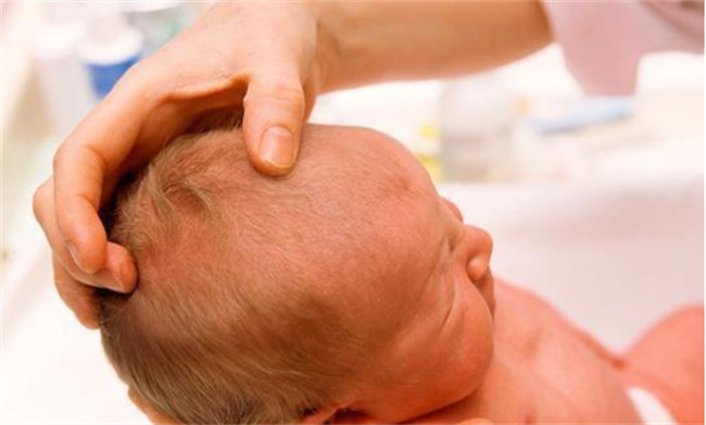 哪两种发型的宝宝可能存在发育异常呢