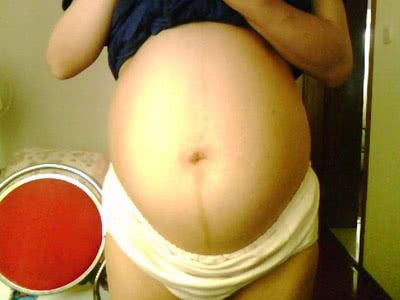 怀孕后肚子上的四种特征,预示着是男孩还是女孩,超准的