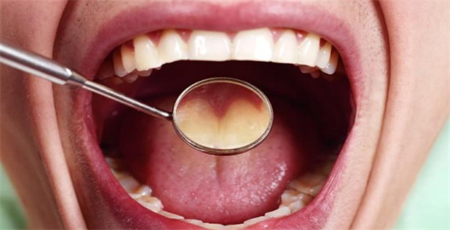 嘴巴苦是什么原因导致，怎么缓解嘴巴苦