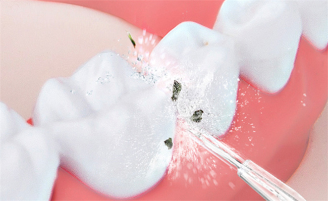什么方式清洁牙齿最有效，清洁牙齿有哪些方法